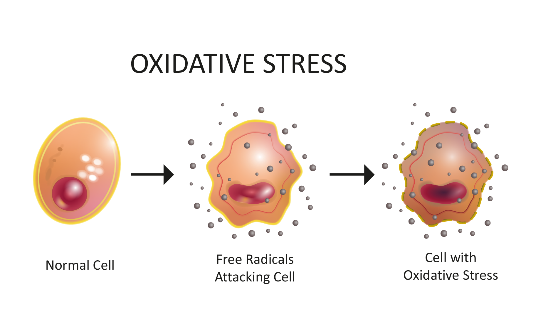 What are free radicals and oxidative stress? - Nutrition Matters Skin